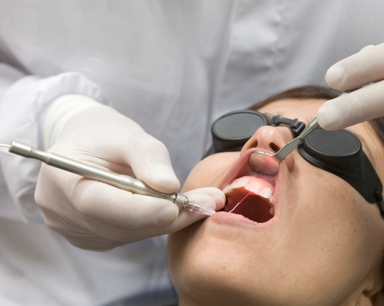 The Benefits Of Laser Dentistry Explained